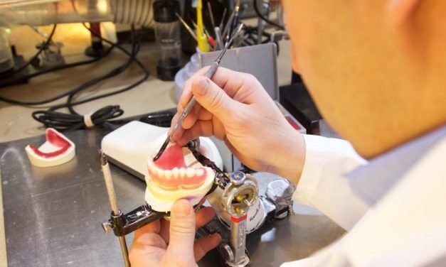 LES AVANTAGES DES PROTHÈSES SUR IMPLANT