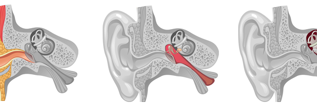 Pourquoi consulter un audiologiste à Ottawa ?