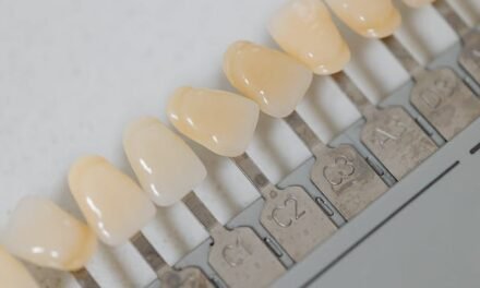 Découvrez les Avantages Exceptionnels de Notre Service de Prothèses Complètes Dentaires à Gatineau