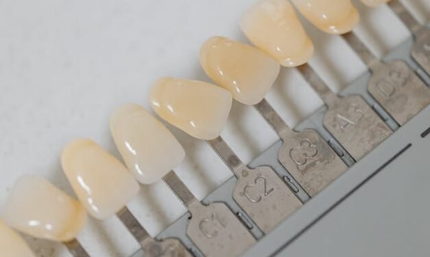 Découvrez les Avantages Exceptionnels de Notre Service de Prothèses Complètes Dentaires à Gatineau