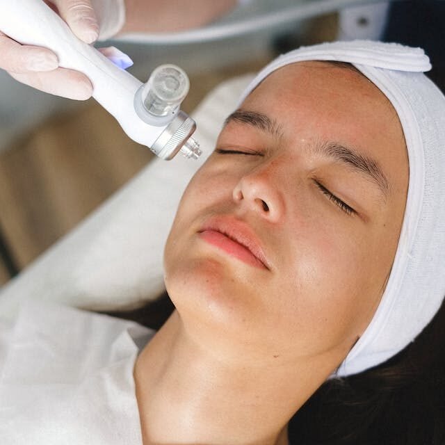 Halo Laser Treatment in Ottawa: Revitalize Your Skin