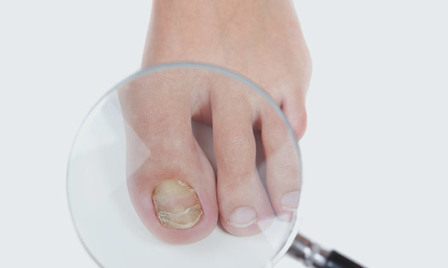 The ultimate guide to foot care in Montreal: Tips for healthy and happy feet