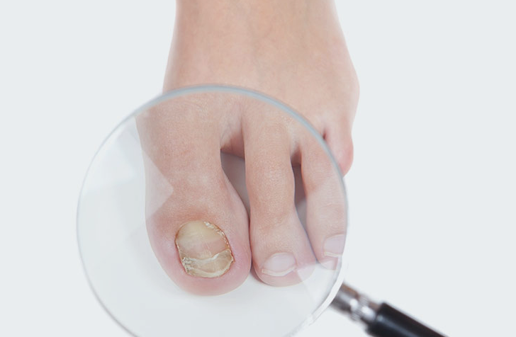 The ultimate guide to foot care in Montreal: Tips for healthy and happy feet