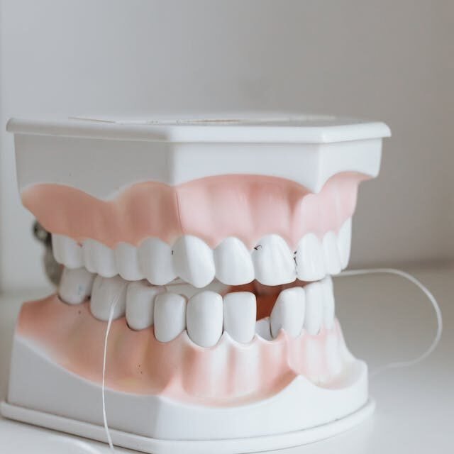 Le service en denturologie à Gatineau : des prothèses dentaires personnalisées pour votre sourire