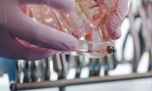 Rétablissez Votre Sourire : Prothèse sur Implant à Gatineau