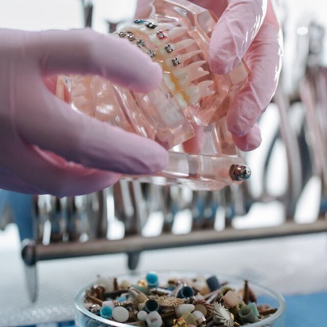 Rétablissez Votre Sourire : Prothèse sur Implant à Gatineau