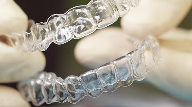 Montréal : Prothèse dentaire à Gatineau : Une alternative à considérer