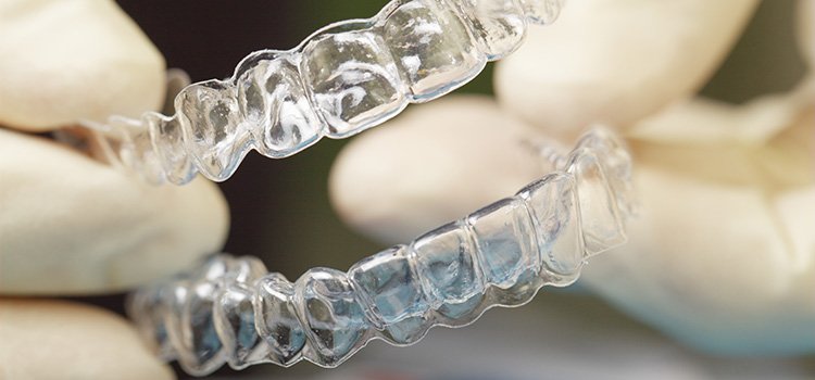 Montréal : Prothèse dentaire à Gatineau : Une alternative à considérer