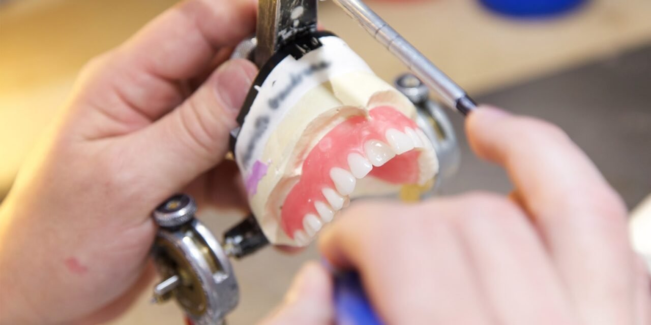 Tout savoir sur les prothèses sur implants à Gatineau pour remplacer vos dents