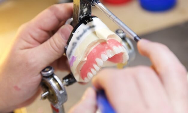 Tout savoir sur les prothèses sur implants à Gatineau pour remplacer vos dents